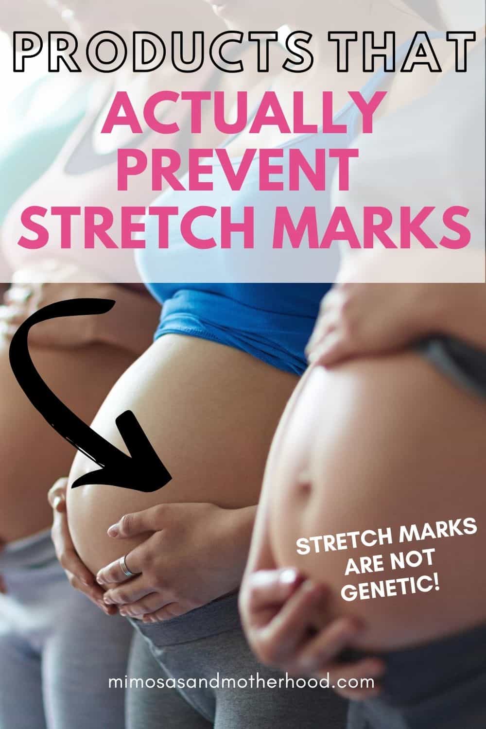 How to avoid stretch marks and saggy skin during pregnancy