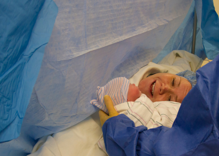 image shows c section birth