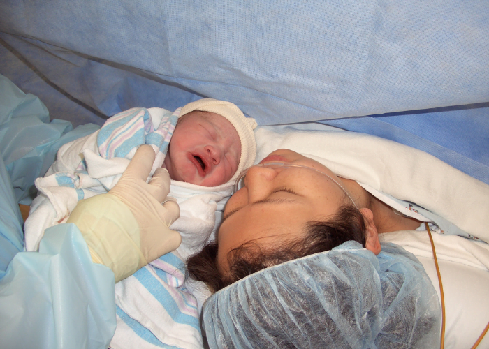 image shows newborn after belly birth