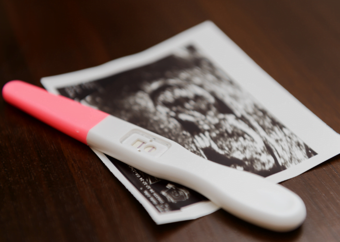 image shows a positive pregnancy test and ultrasound